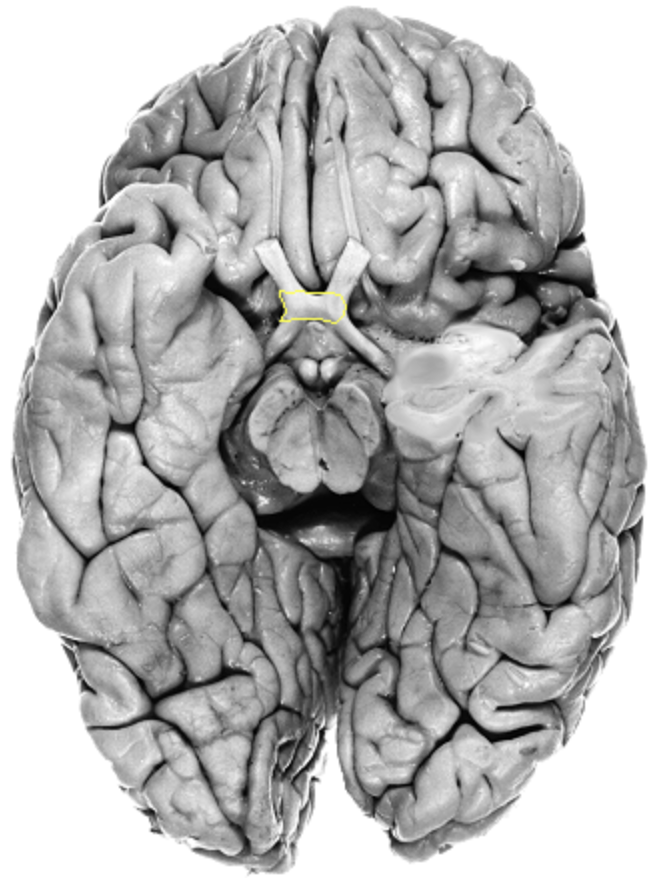 <p>What is the area highlighted called?</p>