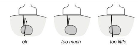 <p>variation in impedance in the tissue causes acoustic waves to be reflected back to the transducer </p><ul><li><p>needs to be enough impedance for the beam to be reflected and not just pass through the tissue</p></li><li><p>but not too much as to stop the wave from reaching deeper structures</p></li></ul><p></p>