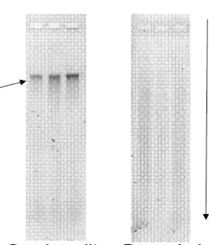 <p>the gel on the LEFT is of __________ DNA</p>