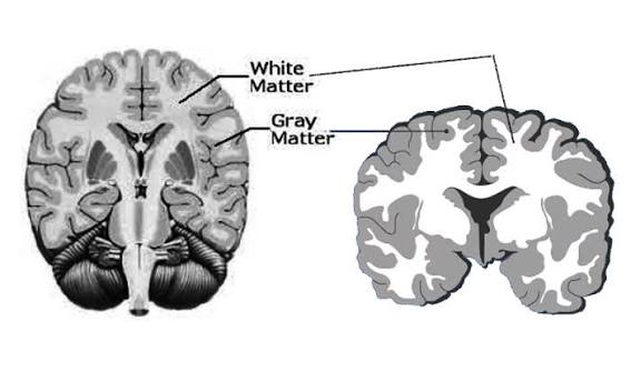 <p>Gray matter</p>