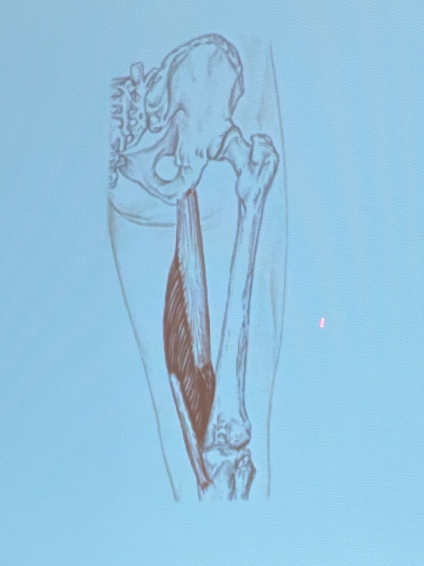 <p>Muscle name?</p>