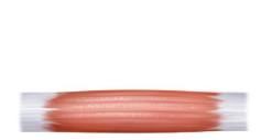 <p><span style="background-color: transparent;">Evenly spaced fascicles, tendon about the same width as muscle&nbsp;</span></p>