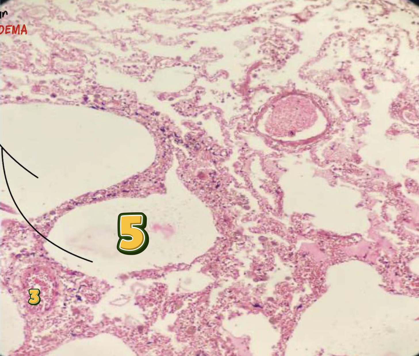 <p>diagnose & identify pointed structure</p>