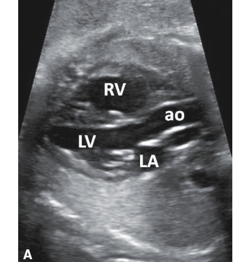 <p>aorta.</p>