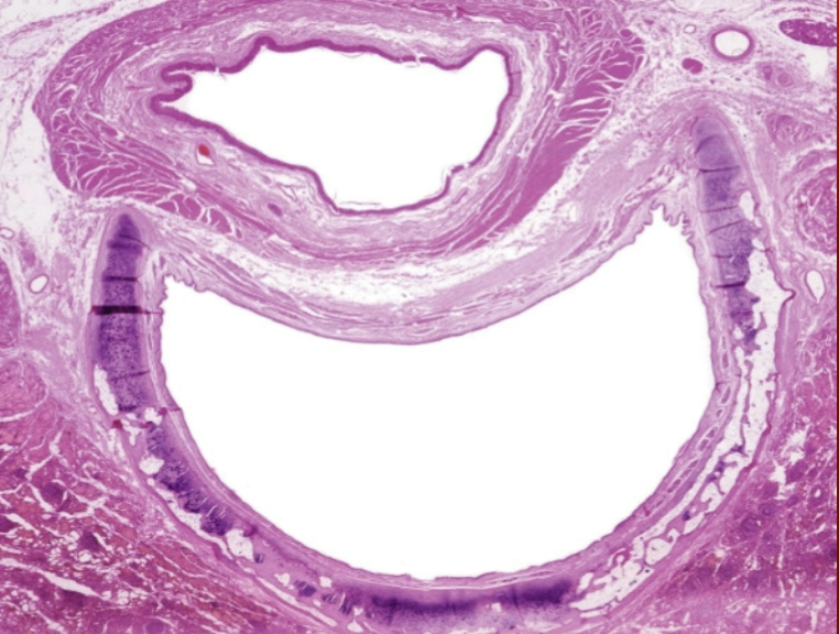 <p>What is that C-shaped hole?</p>