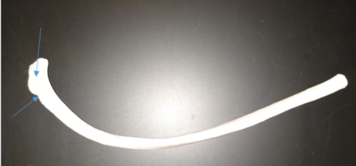 <p>What is this called (below the rib head)?</p>