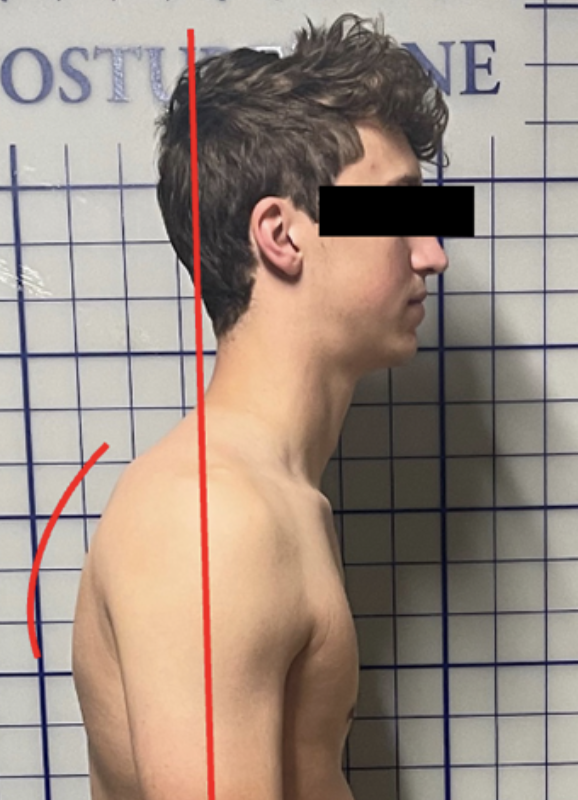 <p>forward head tilt: why?</p>