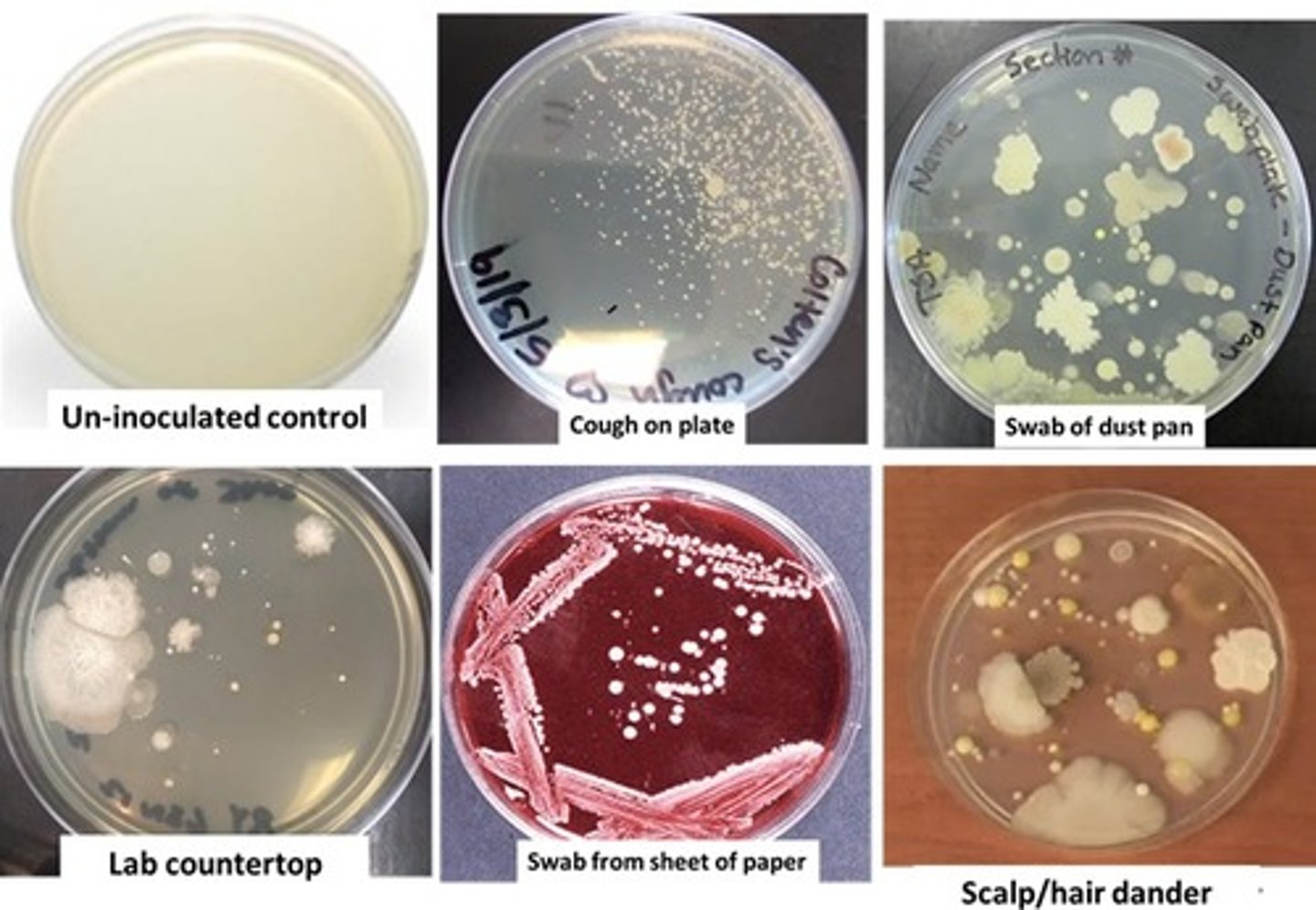 <p>The results of lab exercise 2-1 shown below are, among others, the reason why</p><p>a. hand washing is important</p><p>b. Disinfecting lab countertop is needed</p><p>c. Aseptic techniques were discovered</p><p>d. All of above</p>