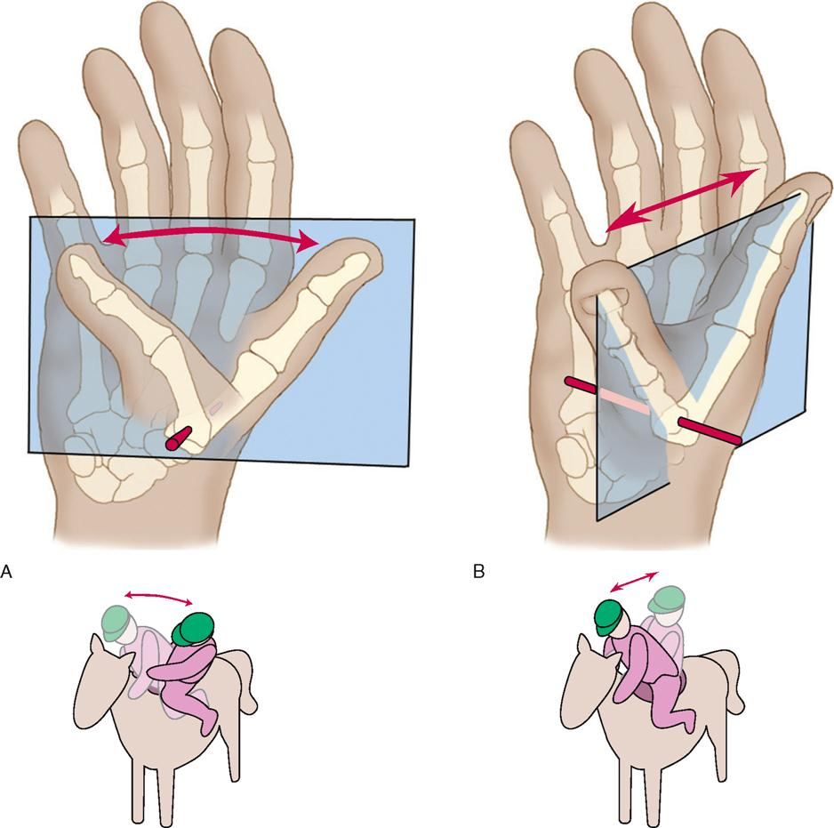 <p>Moves along two axes.</p>