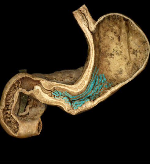 <p>branching folds which run longitudinally, these stretch when stomach is full</p>