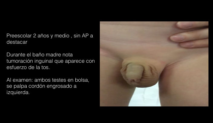 <p>Caso 1</p>