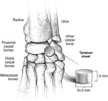 <p>Short Bones </p>