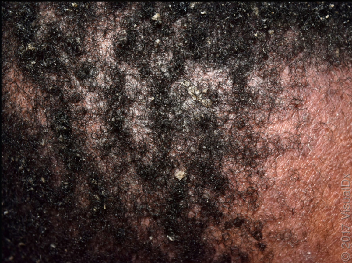 term image