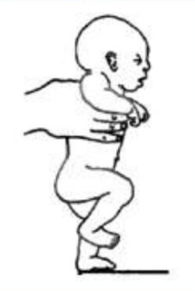 <ul><li><p>primitive reflex - brainstem</p></li><li><p>baby supported vertically around the chest. allow feet to touch support surface. tilt child forward => reciprocal, rhythmical, automatic stepping movement</p></li></ul><p></p>