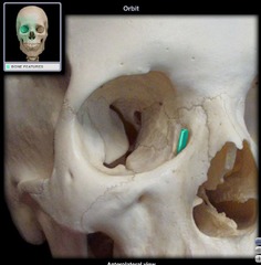 <p>a part of the lacrimal bone</p>