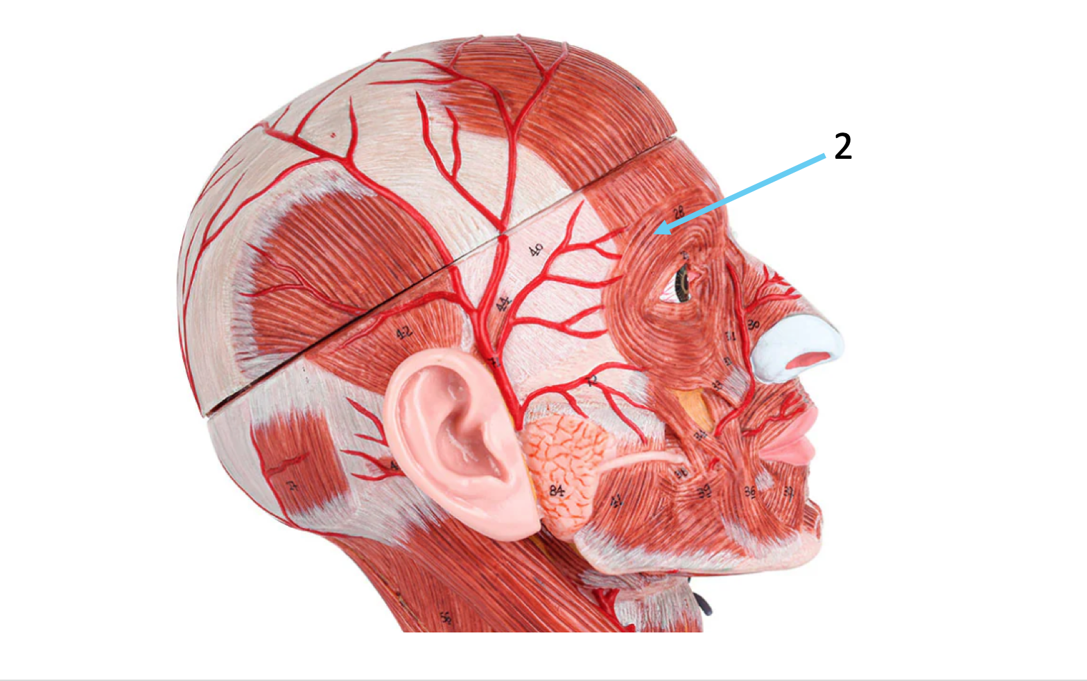 term image