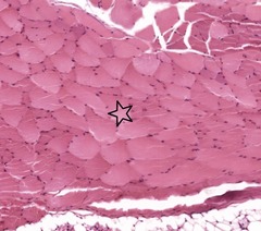 <p>What plane of section are the indicated cells? What type of cells are these?</p>