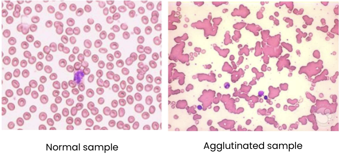 <p>Agglutination</p>