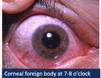 <p>Describe and give diagnosis</p>