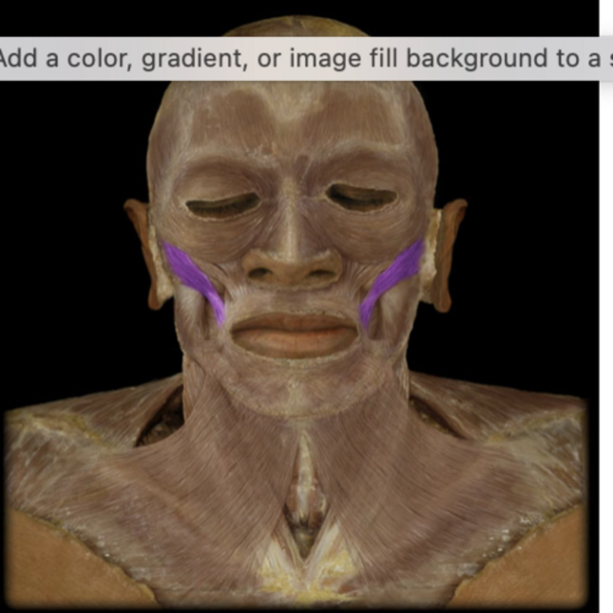 <p>What muscle is indicated in purple?..</p>