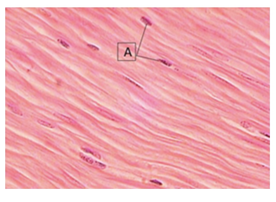 <p>identify this muscle tissue</p>