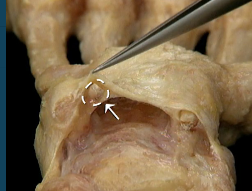 <p>Anterior zicht</p>