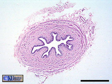 <p>Name this organ of the urinary tract</p>