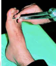 <p>what Hz tuning fork?</p><p>used for vibration sense in neurologic exam (e.g., diabetic neuropathy screening).</p>