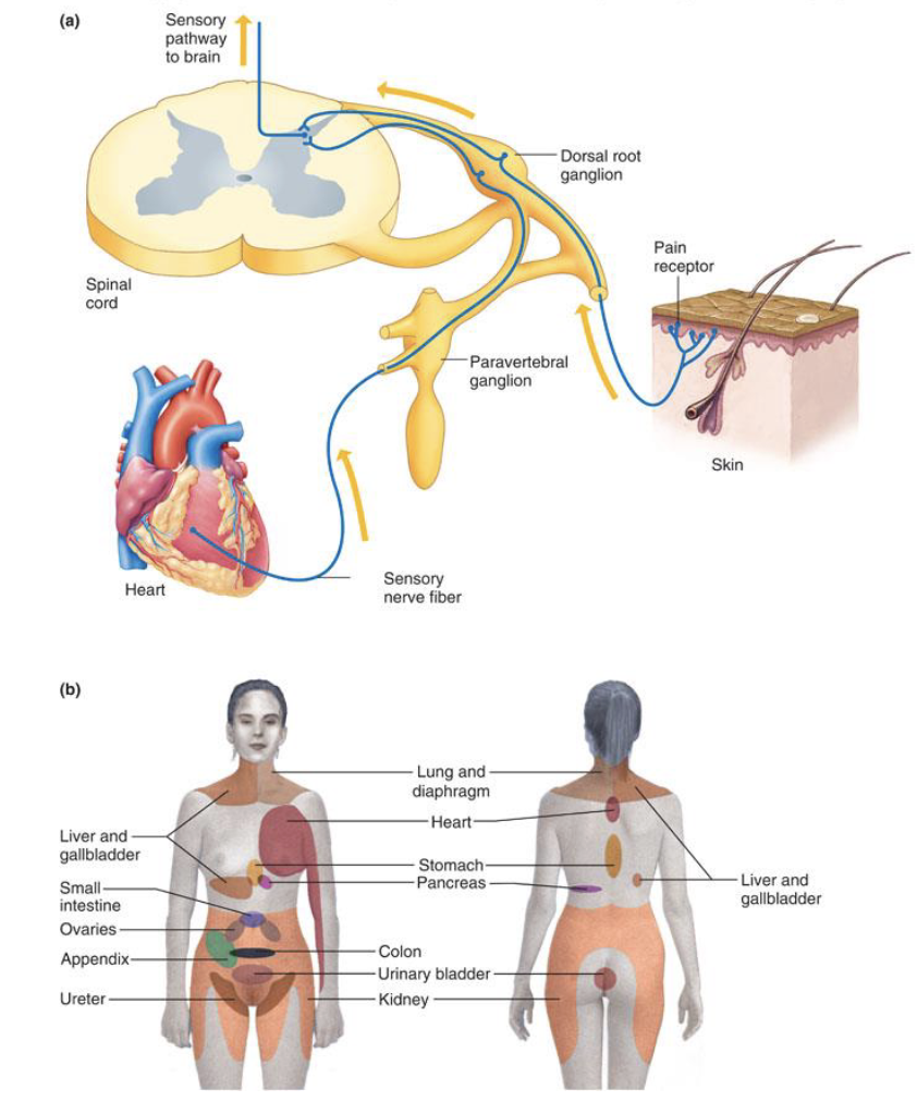 <p>Cross-talk between sensory neurons</p><ul><li><p>Convergence of visceral and somatic afferent neurons (in dorsal root ganglion)</p></li><li><p>Ex: Chest and left arm pain before heart-attack</p></li></ul><p>Issue here? </p><ul><li><p>In STT, the signal should synapse, then <strong><u>cross over</u></strong> and go up to the brain</p></li><li><p>More accurate diagram: </p></li></ul><img src="https://assets.knowt.com/user-attachments/2d2a0a35-0756-4c1b-8327-d0189804a986.png" data-width="50%" data-align="center"><p></p>