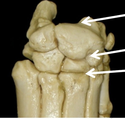 <p>Name the joints pointed by the arrows </p>