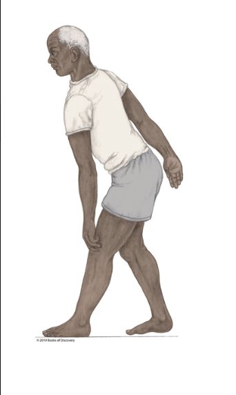 <p><br><span>What muscle is likely weak if a client or patient exhibits the gait pictured below?</span></p>