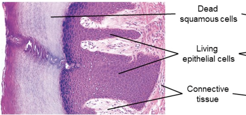 <p>Multiple layers with tough surface layer of dead keratin-filled cells</p>