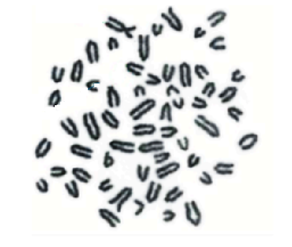 <p><span style="line-height: 20.85px;">Podaj zapis kariotypu przedstawionych poniżej przypadków (gatunek, liczbę chromosomów, płeć, rodzaj mutacji).<strong> </strong></span></p><p><span style="line-height: 20.85px;"><strong><u>Jeśli to możliwe</u></strong> wskaż chromosomy płci i ewentualne chromosomy które uległy mutacjom.</span></p>