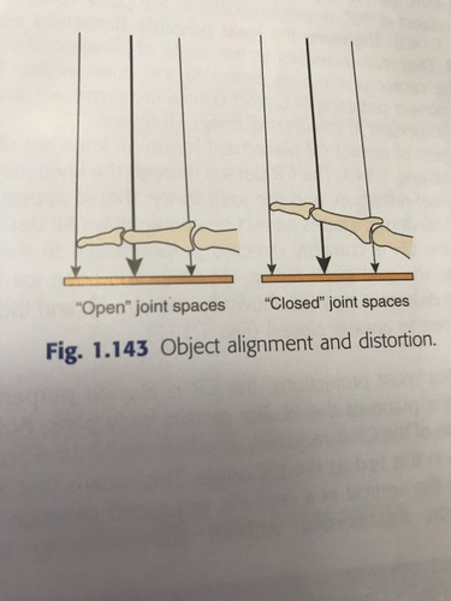 <p>the alignment or plane of the object that is being x rayed in relation to the plane of the IR.</p><p>-if the object is not parallel to the plane of the IR it causes distortion.</p>