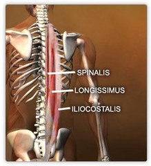 <p>maintaining an upright position for ADLs/IADLs</p><p>brings body back to neutral</p>