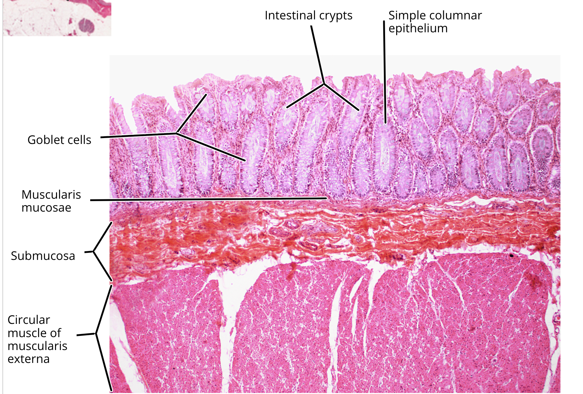<ul><li><p>mucosa </p></li><li><p>muscularis mucosa </p></li><li><p>submucosa</p></li><li><p>muscularis externa</p></li><li><p>serosa </p></li><li><p><strong>colonocyte </strong></p></li><li><p><strong>goblet cell</strong></p></li></ul><p></p>