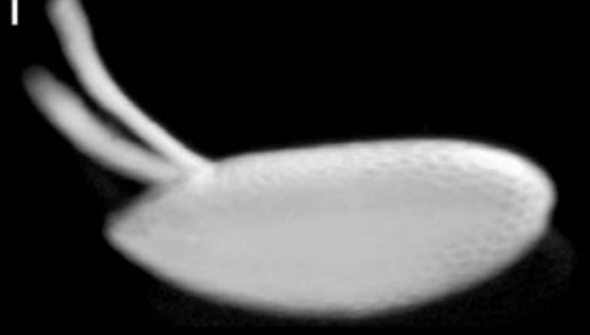 <p>Describe what you see in the figure below.</p>