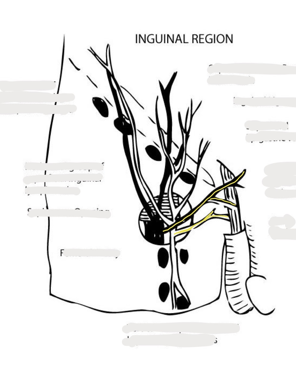 <p>Name This</p>