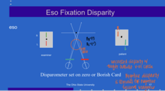 <p>How will a patient with an ESO deviation observe the disparometer?</p>