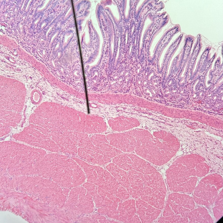 <p>Which segment of the digestive tract is this?</p>