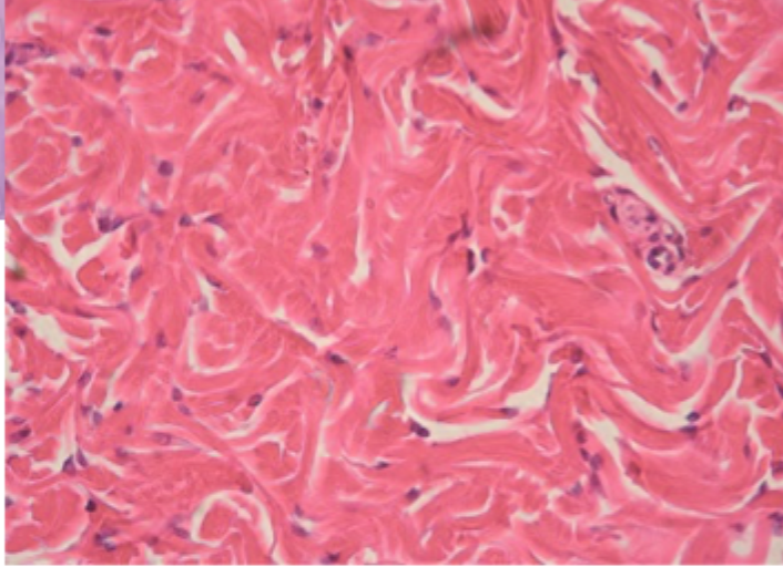 <p>Hvorfor er dermis stærkt men mere fleksibelt end knogle?</p>