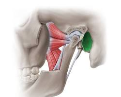 <p>What is this pointing to? What bone is it on?</p>