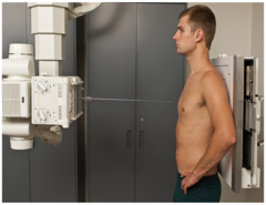 <p>X-ray beam enters the anterior surface and exits the posterior.</p>