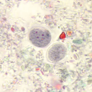 <p>Spherical (5-10 um), 4 nuclei,</p><p>Lacks peripheral chromatin</p>