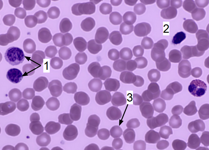 <p>blood connective tissue </p>