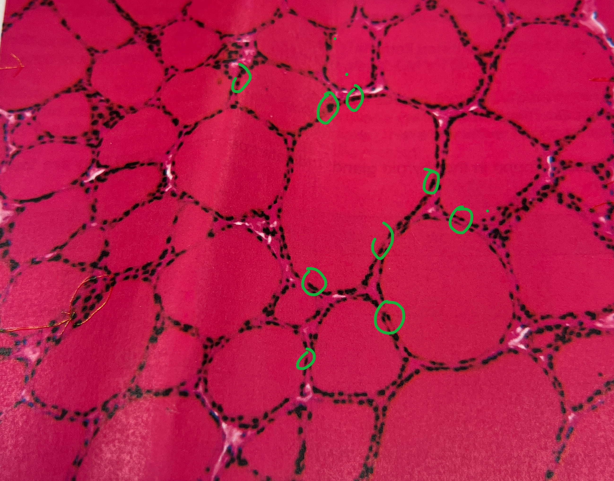 <p>What are the dots called in the thyroid gland?</p>