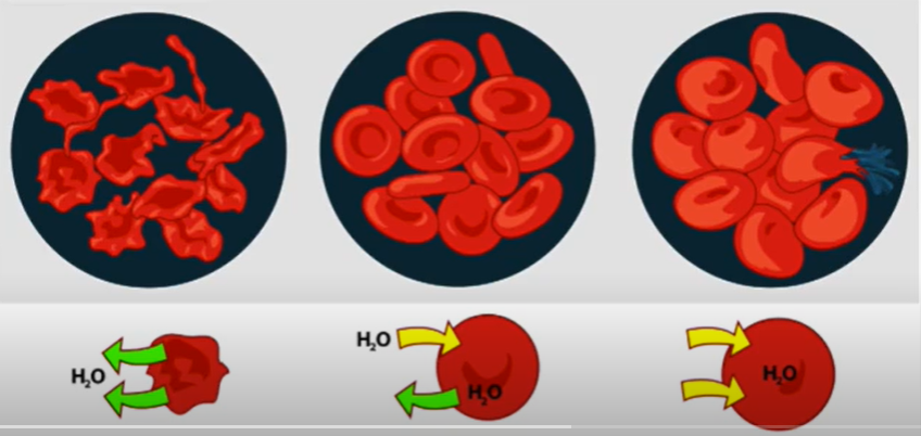 <p><span>Which statement is correct?</span><br><br>A. Osmotic pressure is the minimum amount of pressure that needs to be applied to a surface to prevent the inward flow of water across the semi-permeable membrane.</p><p> </p><p>B. Osmotic pressure is the maximum amount of pressure that needs to be applied to a surface to prevent the inward flow of water across the permeable membrane.</p><p> </p><p>C. Osmotic pressure is the maximum amount of pressure that needs to be applied to a surface to prevent the inward flow of water across the semi-permeable membrane.</p><p> </p><p>D. Osmotic pressure is the minimum amount of pressure that needs to be applied to a surface to prevent the inward flow of water across the permeable membrane.</p>