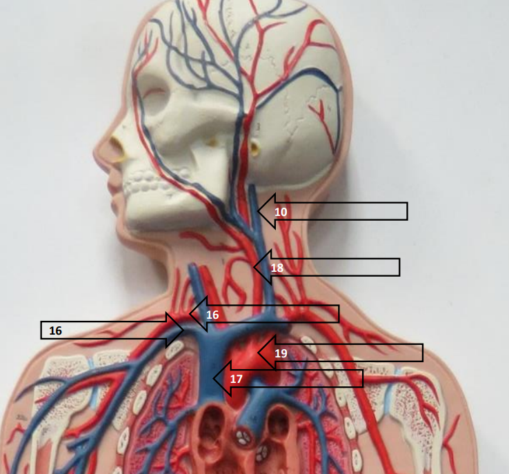 <p>Label this image.</p>