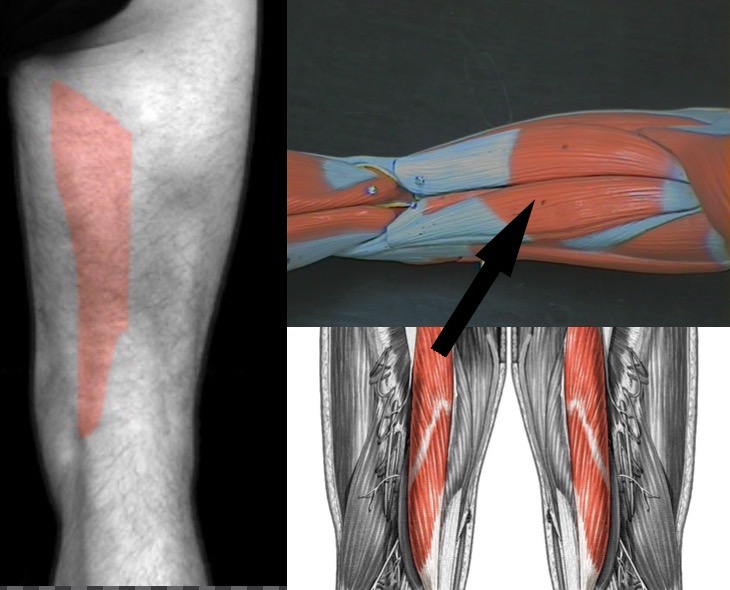 <p>What muscle is this?</p>