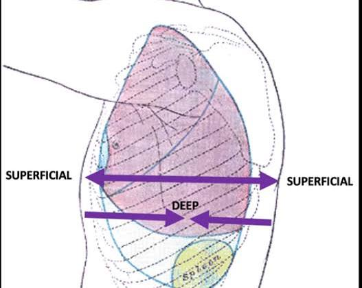 <p>Near the outermost layer or surface of the skin.. <span style="background-color: transparent;">Situated near the surface of the body; opposite of deep</span></p>